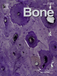 Bone.gif