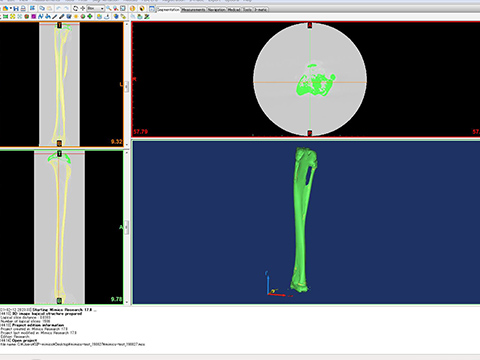 3D画像処理ソフトウェア Mimics